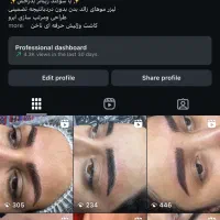 میکروبلیدینگ ابرو