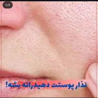 پاکسازی با.  70٪  تخفیف قیمت 120 بمدت یکماه|آرایشگاه و سالن‌های زیبایی|اصفهان, آزادگان|دیوار