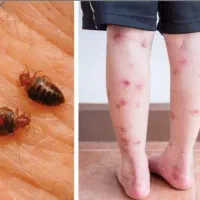 سمپاشی ساس سوسک کنه موش تضمینی در یک جلسه