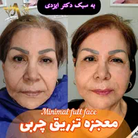 چربی بیکینی لابیا پلاستی تنگی انواع جراحی لیفت|خدمات آرایشگری و زیبایی|شیراز, شهرک گلستان|دیوار