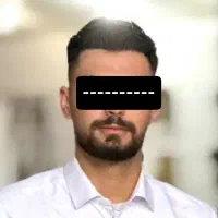 کاشت مو/کاشت ابرو/کاشتمو