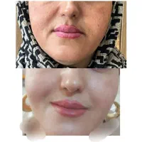 با ما بدرخشید واز شرلک هات خلاص شو