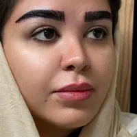 مدل کاشت مو و ابرو جهت تولید محتوا|خدمات آرایشگری و زیبایی|قم, پردیسان|دیوار