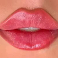 جشنواره ی پاییزه ژل ،بوتاکس،مزو