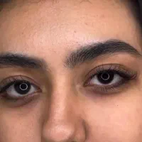کاشت مژه