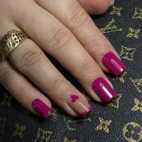 کاشت و ترمیم تخفیف تا پایان هفته