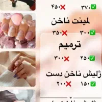 کاشت ناخن با تخفیف ویژه