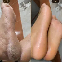 پدیکور کفسابی