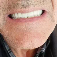 دندان masnoee|خدمات آرایشگری و زیبایی|بهار, |دیوار