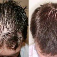 همش به خاطر استرس الکی بوداا