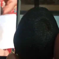 شهاب سنگ و سنگ درمانی