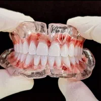 دندان مصنوعی(پروتز) با امکان قالبگیری در محل شما.