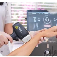 زگیل تناسلی  خال میخچه آقایان بانوان