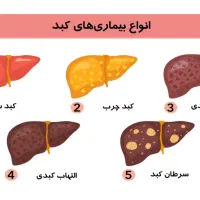 درمان کبد چرب گرید 1تا 3