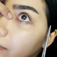 بلفاروپلاستی رفع افتادگی پلک لیزری/سانترال/بوکالفت|خدمات آرایشگری و زیبایی|تهران, هفت حوض|دیوار