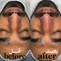 فشیال تخصصی آقایان « پاکسازی پوست » فیشیال فیشال|خدمات آرایشگری و زیبایی|مشهد, الهیه|دیوار
