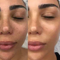 فشیال ۵۹۰،لیزر۸۹۰تیتانیوم رولی ۹۹۰الکساندرایت شاتی
