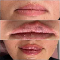 بیماریاب زیبایی