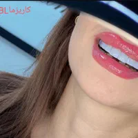 مرکز خدمات کامپوزیت دندان شیراز دندانپزشکی|خدمات آرایشگری و زیبایی|شیراز, قصرالدشت|دیوار