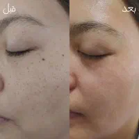 خدمات تخصصی پوست،فیشال،مطب