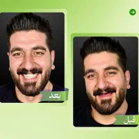 مرکز تخصصی ایمپلنت دیجیتال/اقساط/یکروزه/کاشت دندان|خدمات آرایشگری و زیبایی|تهران, پاسداران|دیوار