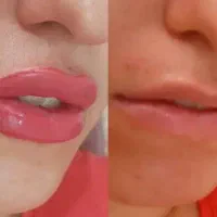 مدل میخوام جهت تاتو و پاک کردن تاتو(زیر نظر استاد)|خدمات آرایشگری و زیبایی|کاشان, دشت چال|دیوار