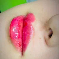 اف ویژه تمام خدمات زیبایی و جراحی در مطب