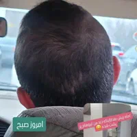روغن بادام شیرین و محصولات گیاهی و درمانی نیوشا|خوردنی و آشامیدنی|مشهد, کلاهدوز|دیوار