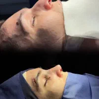 عمل بینی|خدمات آرایشگری و زیبایی|سمنان, |دیوار