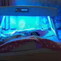 دستگاه زردی نوزاد