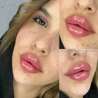 کلینیک زیبایی غزل