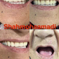 دندان مصنوعی|خدمات آرایشگری و زیبایی|پرند, فاز ۲|دیوار