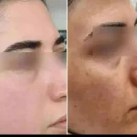 کرم معجزه اصل ۳عدد زیرقیمت|آرایشی، بهداشتی، درمانی|شیراز, شاپورجان|دیوار