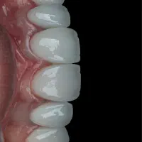 منشی لابراتوار دندانسازی