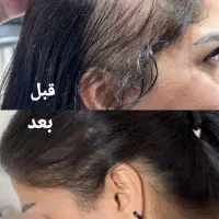 مدل رایگان کراتین و اسکراب اسکالپ