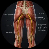 طب سنتی درمان دیسک و سیاتیک بدون جراحی