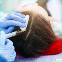 تخفیف ویژه پاییزه مزو تراپی مو و ابرو