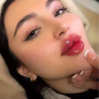 تخفیفات ویژه ژل و بوتاکس پی آرپی