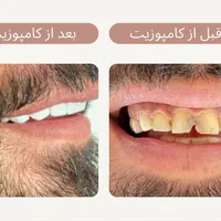 خدمات زیبایی دندان|خدمات آرایشگری و زیبایی|مشکین‌دشت, |دیوار