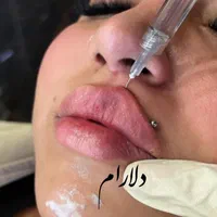 ژل و بوتاکس - مدلنیگ عربی-آموزش حرفه ای|خدمات آرایشگری و زیبایی|شیراز, شهرک مهرگان|دیوار