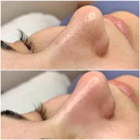 فشیال|خدمات آرایشگری و زیبایی|ساوه, |دیوار