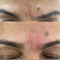 تزریق ژل. بوتاکس|خدمات آرایشگری و زیبایی|کرج, حصارک پایین|دیوار