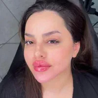 فروش ژل بوتاکس نخ و لوازم بهداشتی کلینیک  زیبایی|خدمات آرایشگری و زیبایی|تهران, قیطریه|دیوار