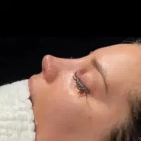 مشاوره و نوبت ویزیت رایگان بینی