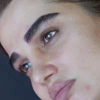 کاشت مو ابرو ریش بلفاروپلاستی