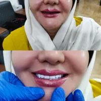 دندان ،دندان سازی ،دندان مصنوعی ،جوان پسند،اقساطی