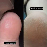 پارافین تراپی وپدیکوروکفسابی پاویژه آقایون وبانوان|خدمات آرایشگری و زیبایی|اصفهان, چشمه باقرخان|دیوار