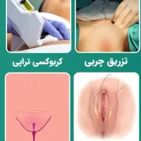 زنان/مطب/درمانی و زیبایی|خدمات زیبایی و سلامت|شیراز, فضلآباد|دیوار