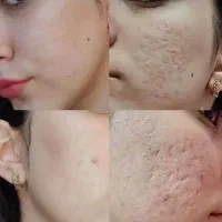 اگه میخای دوروزه نتیجه بگیری تماس بگیر یا پیام بد