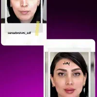 تخفیف ویژه تزریق فیلروبوتاکس باماندگاری بالا|خدمات آرایشگری و زیبایی|فلاورجان, |دیوار